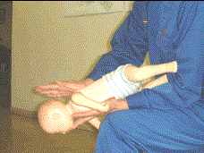 写真：背部叩打法（1歳未満の乳児・新生児）2